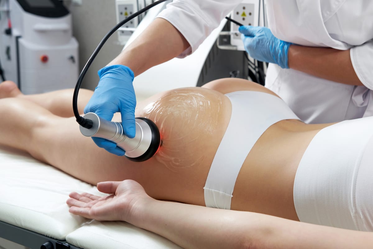 Cavitazione estetica al CTE di Roma